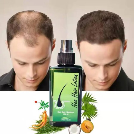 Neo Hair Lotion-120ml