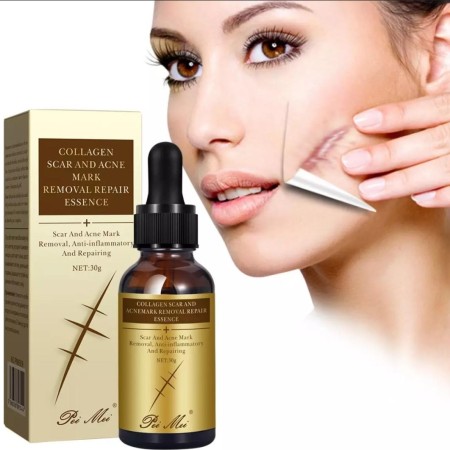 Collagen Scar & Acne Mark Removal Repair Essence